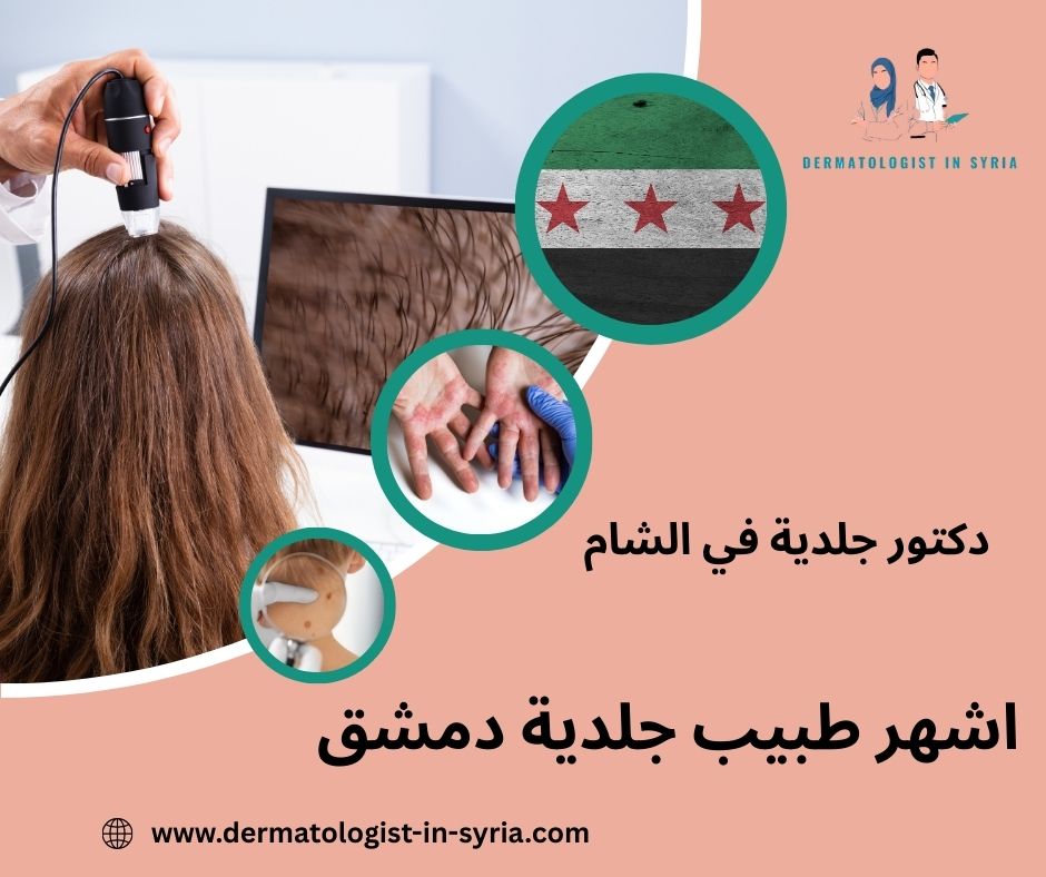 اشهر طبيب جلدية دمشق