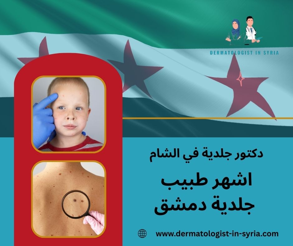 اشهر طبيب جلدية دمشق