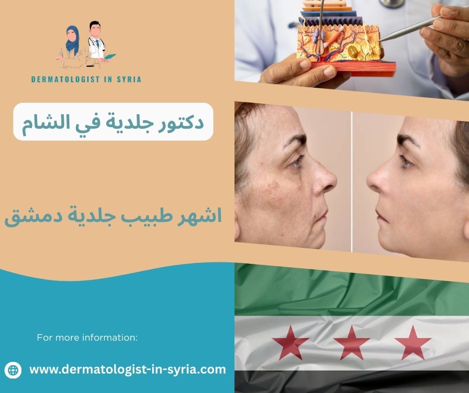 اشهر طبيب جلدية دمشق
