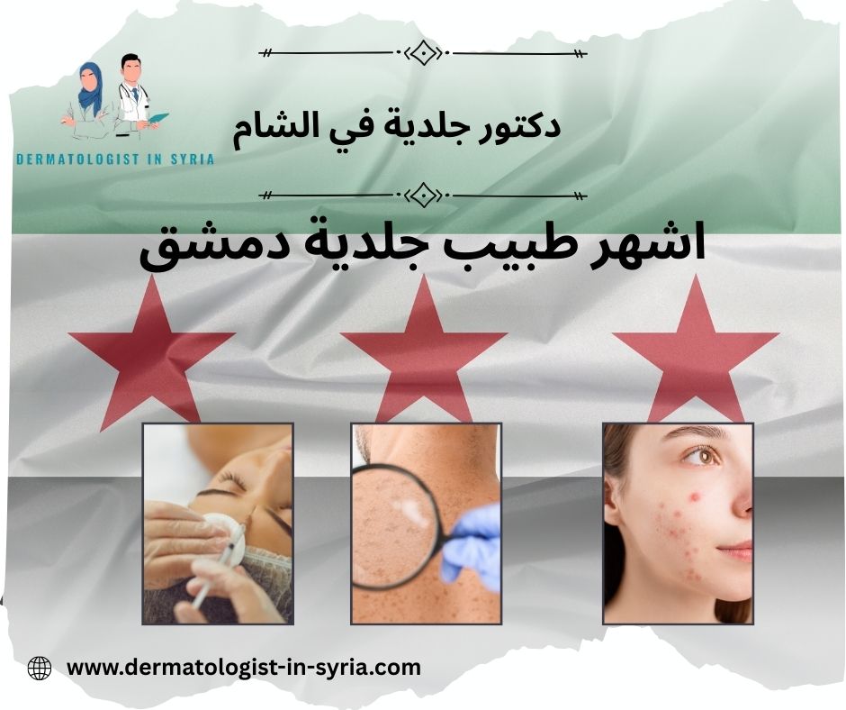 أفضل طبيب جلدية في دمشق