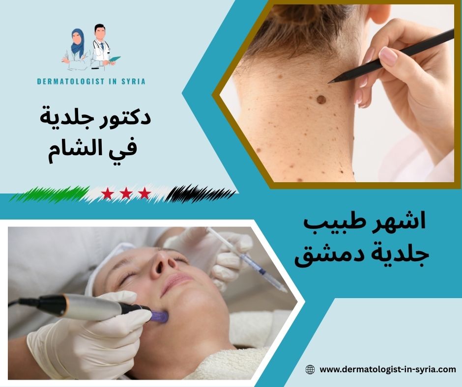 طبيب جلدية دمشق