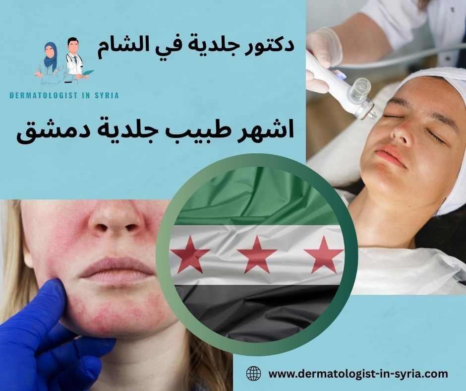 طبيب جلدية دمشق المزة