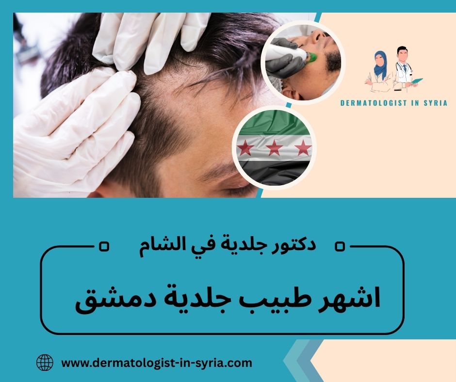 اشهر طبيب جلدية دمشق
