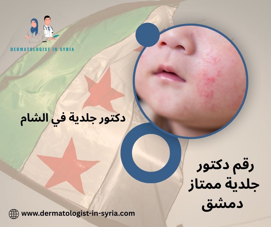 رقم دكتور جلدية ممتاز دمشق