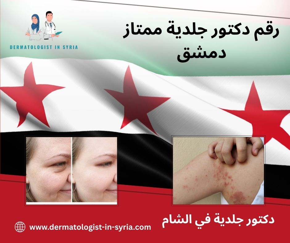 رقم دكتور جلدية ممتاز دمشق
