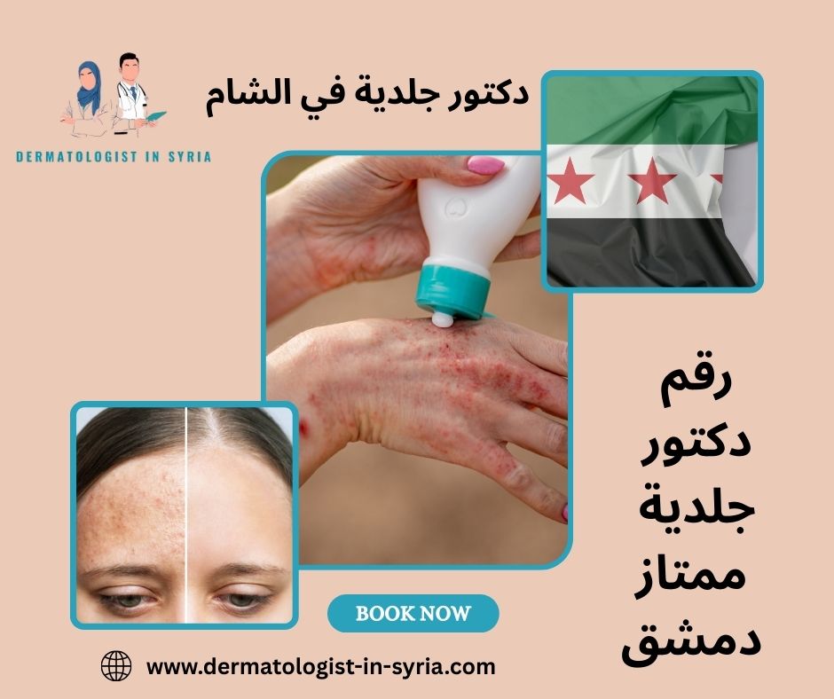 رقم دكتور جلدية ممتاز دمشق