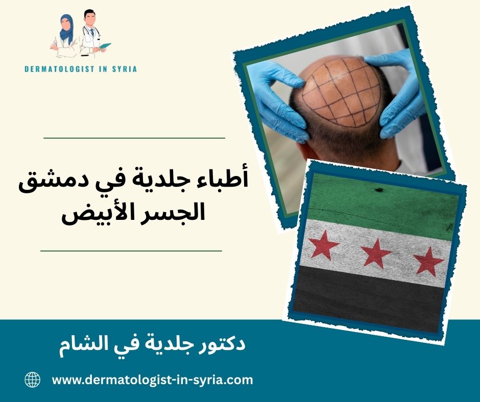 دكتور جلدية دمشق الحمرا