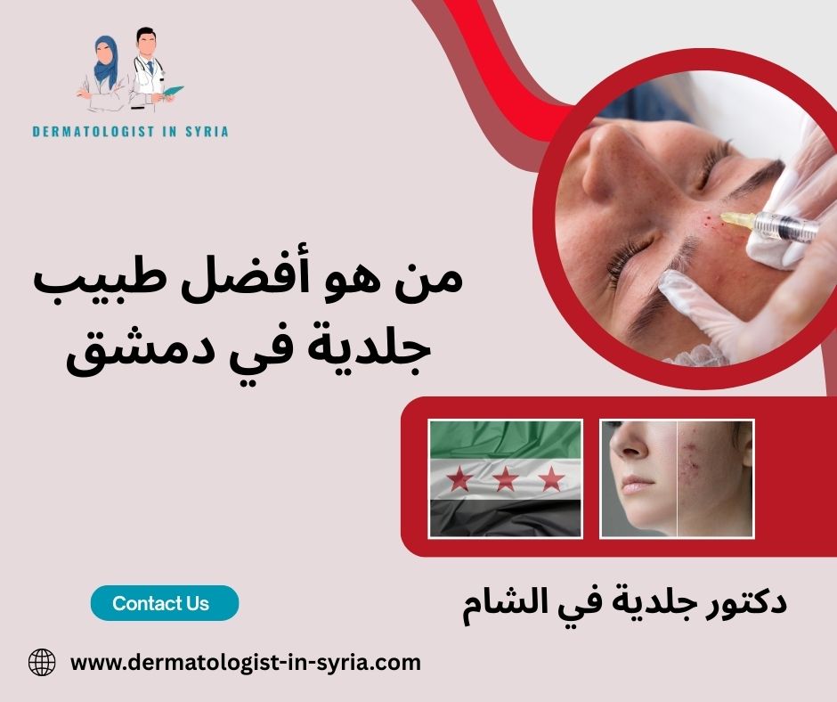افضل دكتور جلدية في دمشق