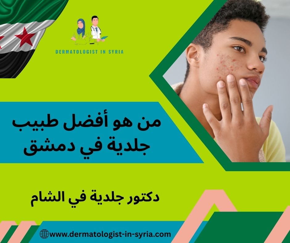 افضل طبيب جلدية في دمشق