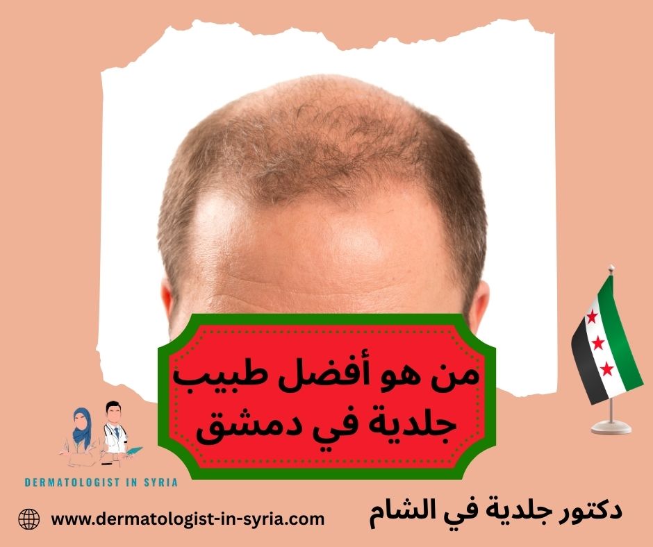 من هو أفضل طبيب جلدية في دمشق