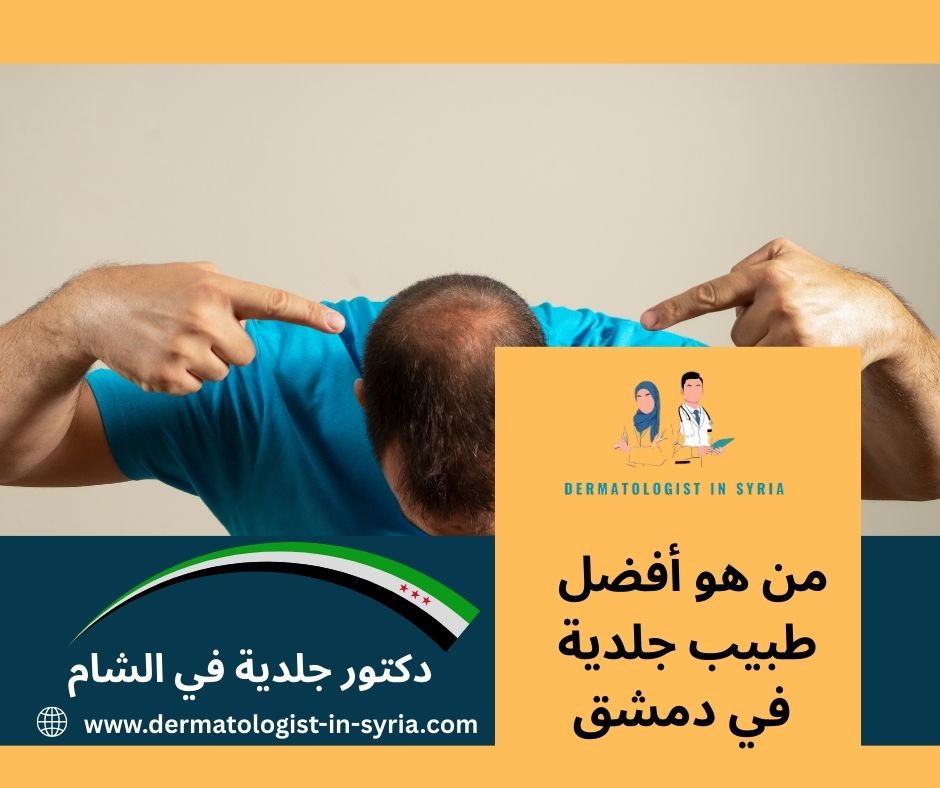 من هو أفضل طبيب جلدية في دمشق