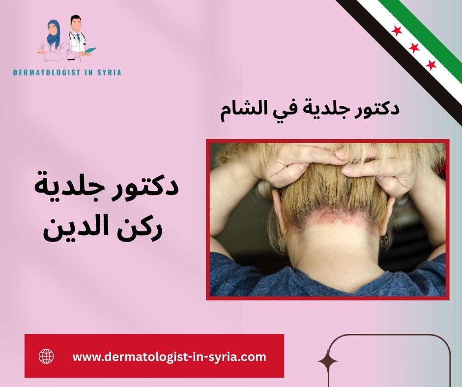 دكتورة جلدية شاطرة في دمشق