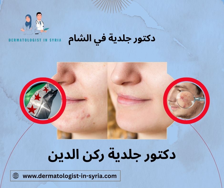 دكتور جلدية ركن الدين