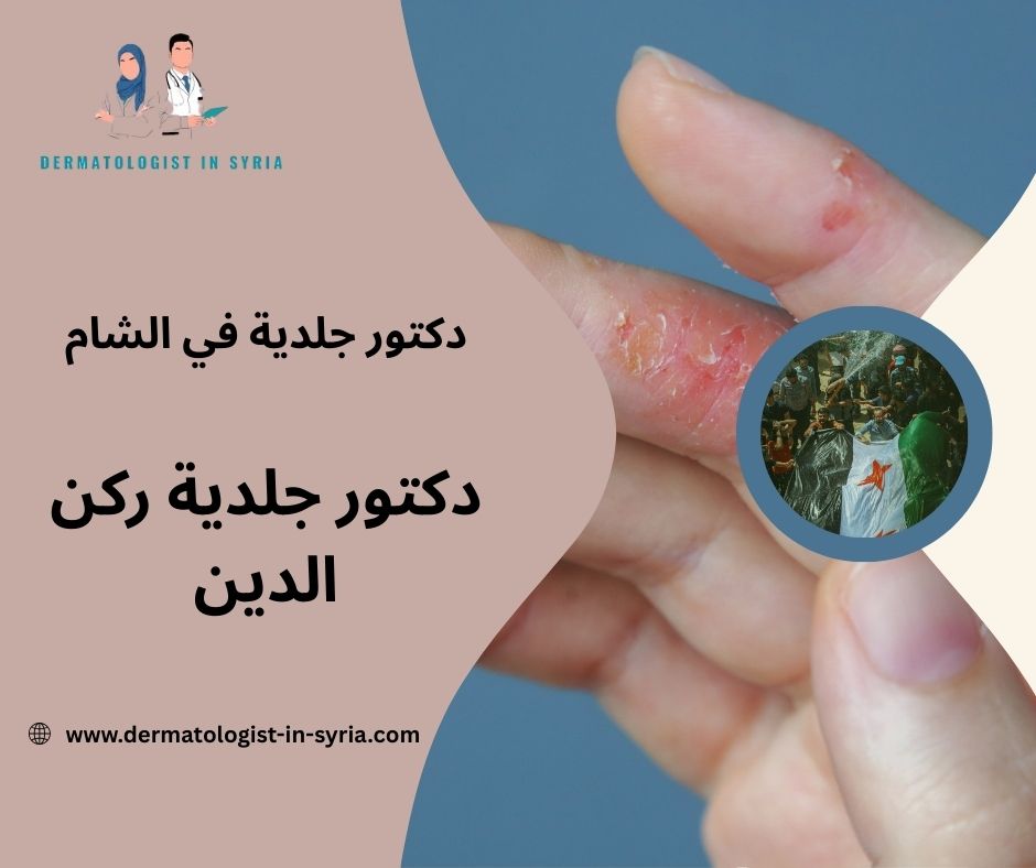 دكتور جلدية ركن الدين