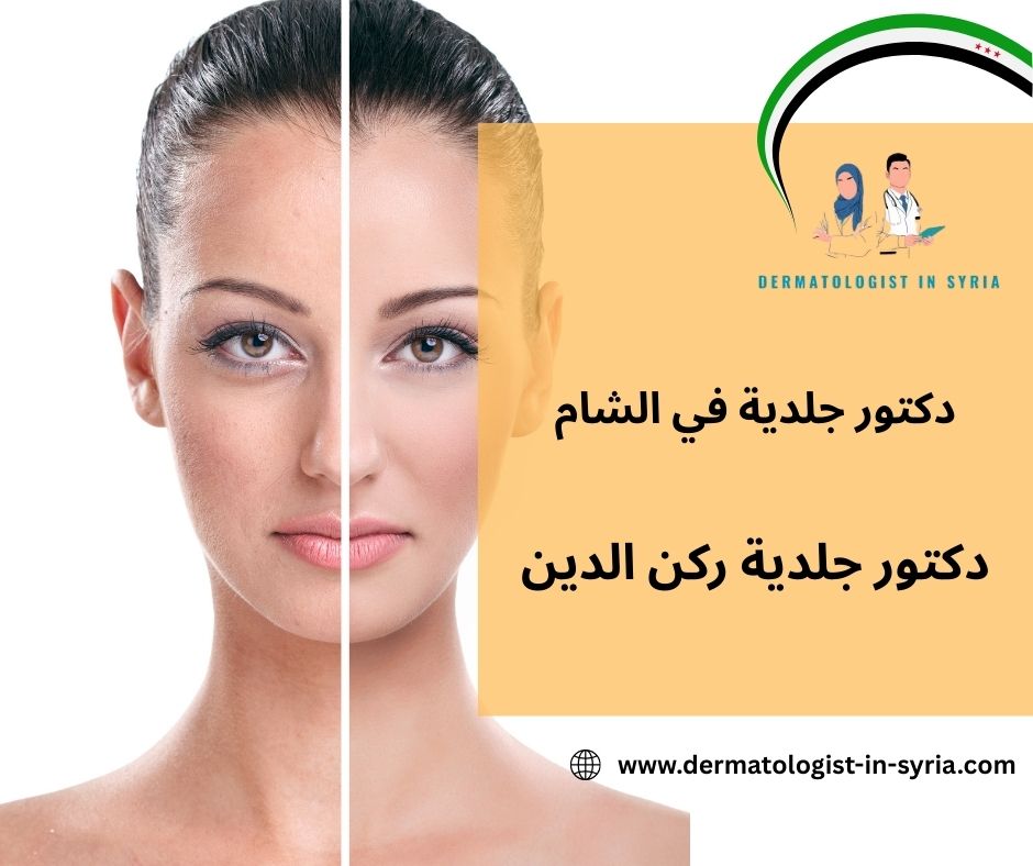 دكتور جلدية ركن الدين