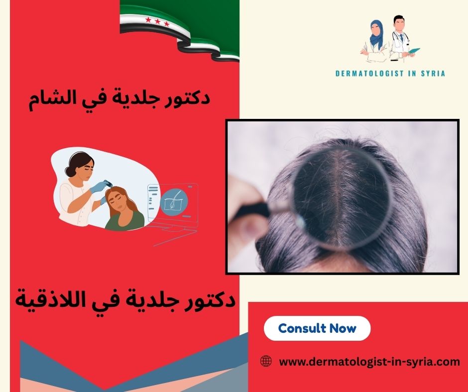 افضل دكتور جلدية في دمشق