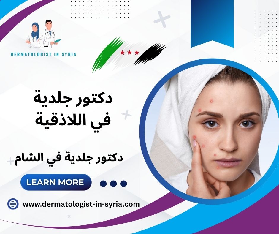 دكتور جلدية اللاذقية