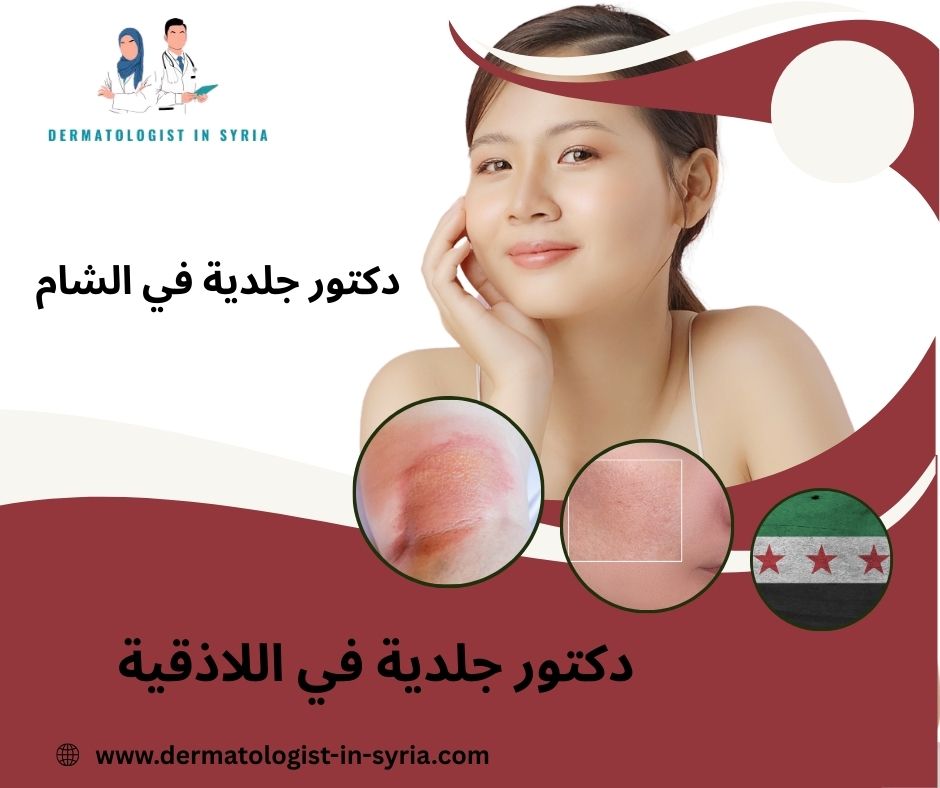 اشطر دكتور جلدية في اللاذقية