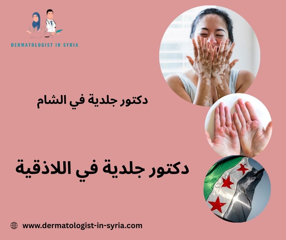 دكتور جلدية في اللاذقية