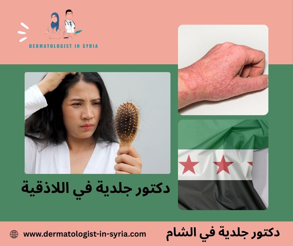 دكتور جلدية في اللاذقية