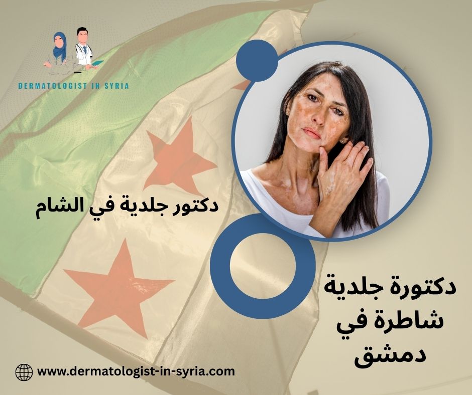 رقم دكتور جلدية ممتاز دمشق