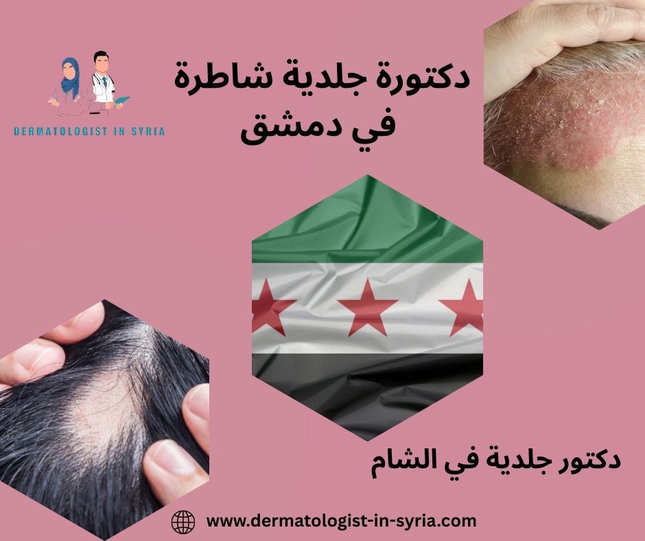 دكتورة جلدية شاطرة في دمشق