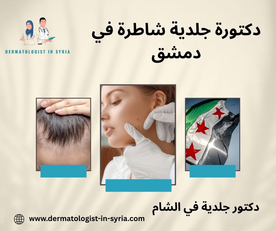 دكتورة جلدية شاطرة في دمشق