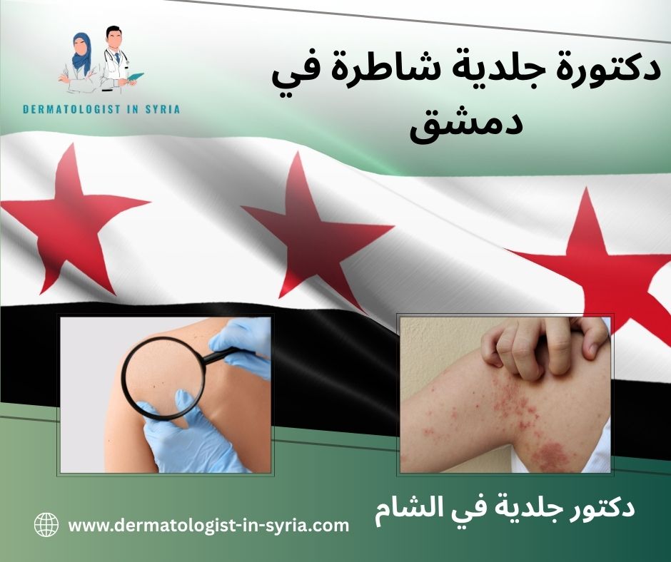 دكتورة جلدية شاطرة في دمشق