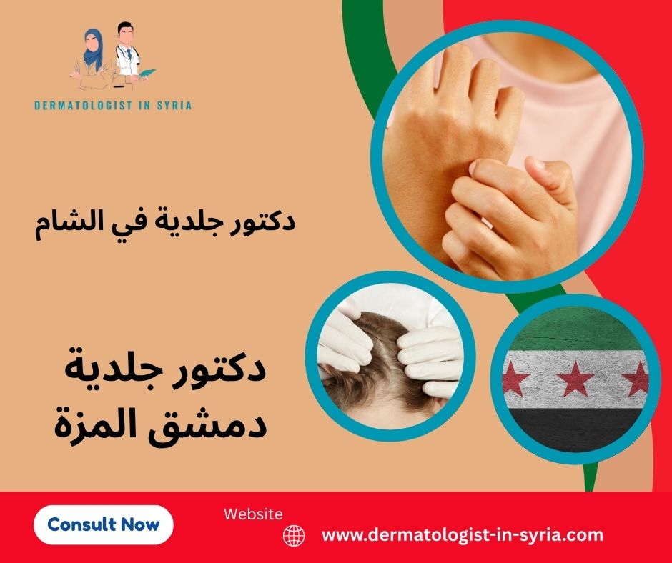 دكتور جلدية دمشق المزة
