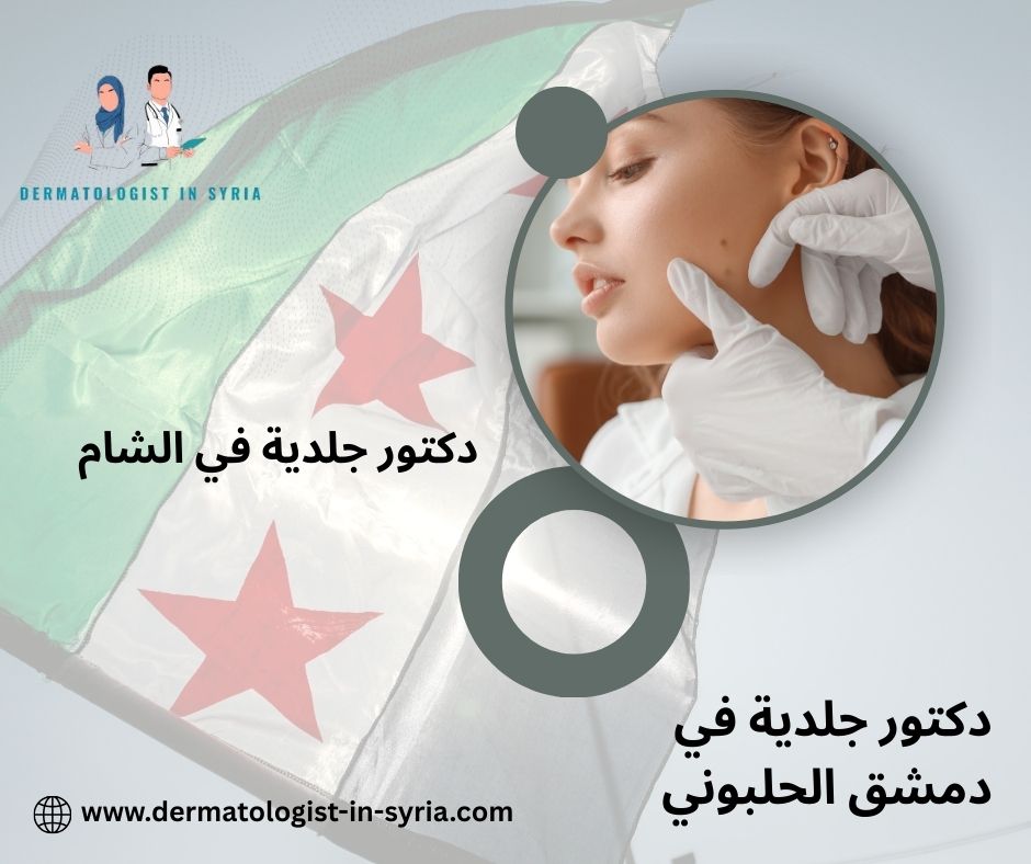 دكتور جلدية في دمشق الحلبوني دكتور جلدية في دمشق الحلبوني