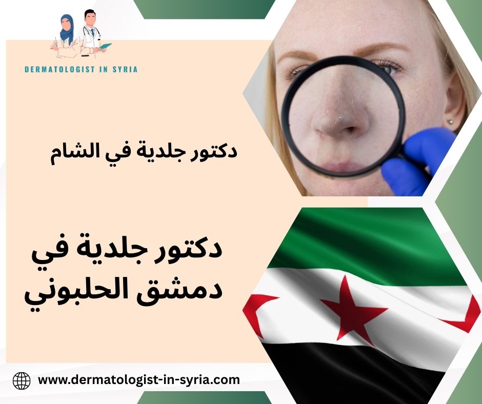 دكتور جلدية في دمشق الحلبوني دكتور جلدية في دمشق الحلبوني