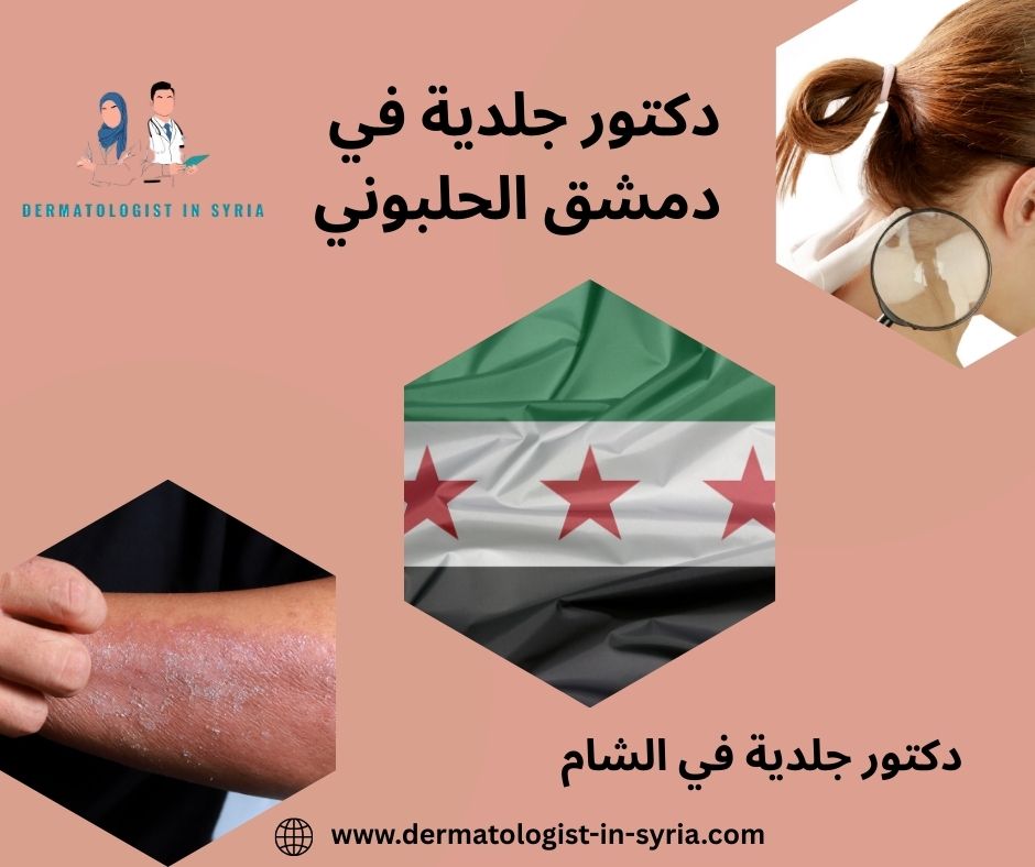 افضل دكتور جلدية في دمشق افضل دكتور جلدية في دمشق