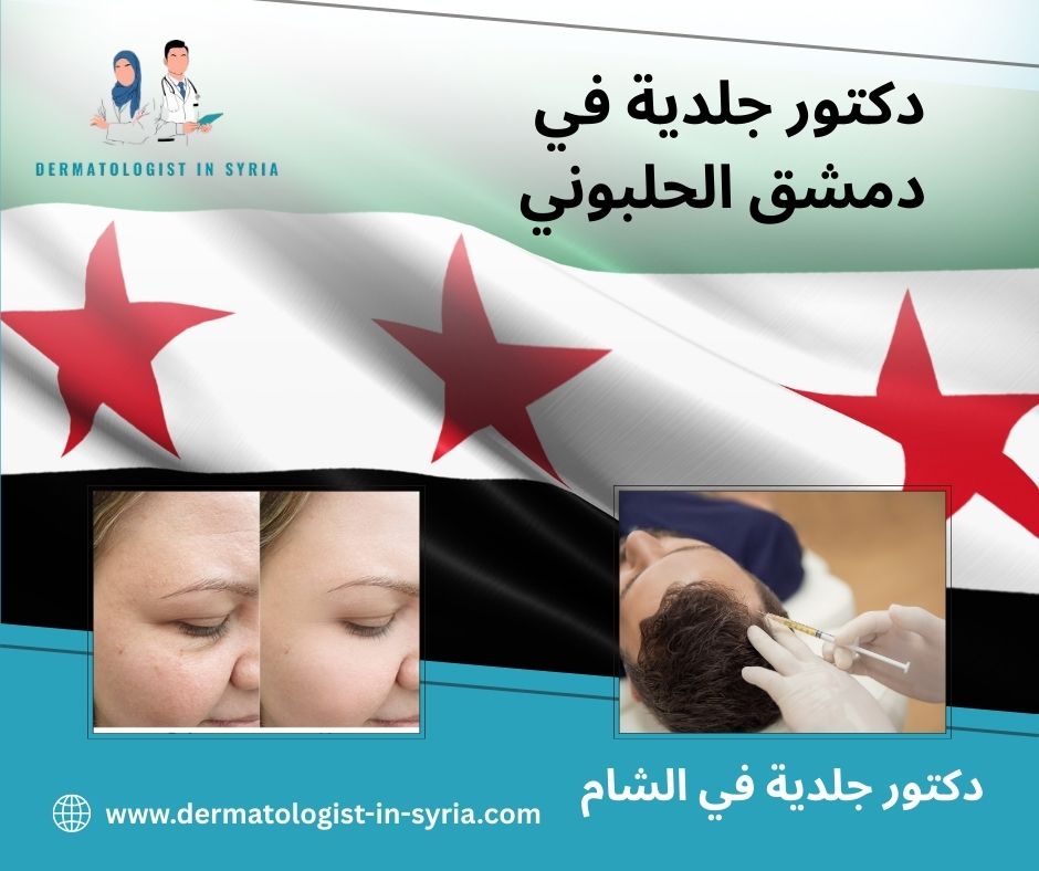 دكتور جلدية في دمشق الحلبوني