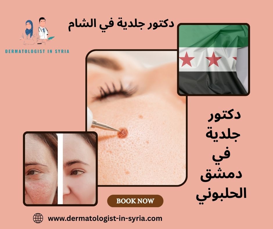 من هو اشطر دكتور جلدية في دمشق الحلبوني؟ من هو اشطر دكتور جلدية في دمشق الحلبوني؟