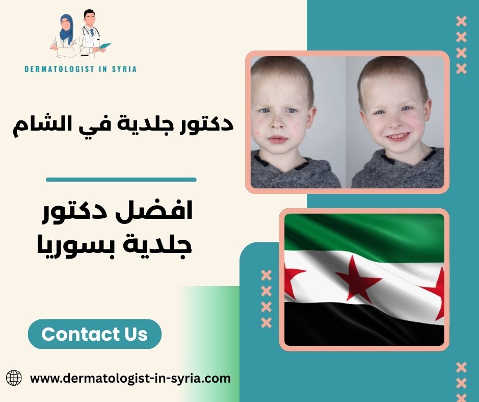 افضل دكتور جلدية بسوريا