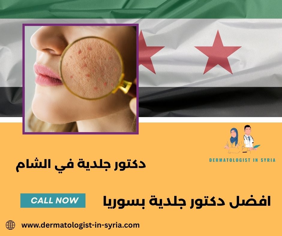 افضل دكتور جلدية في دمشق افضل دكتور جلدية في دمشق