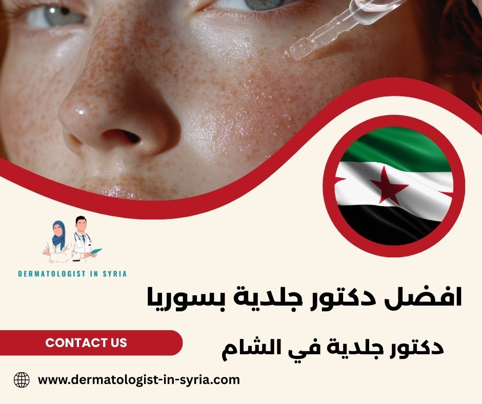 افضل دكتور جلدية بسوريا افضل دكتور جلدية بسوريا