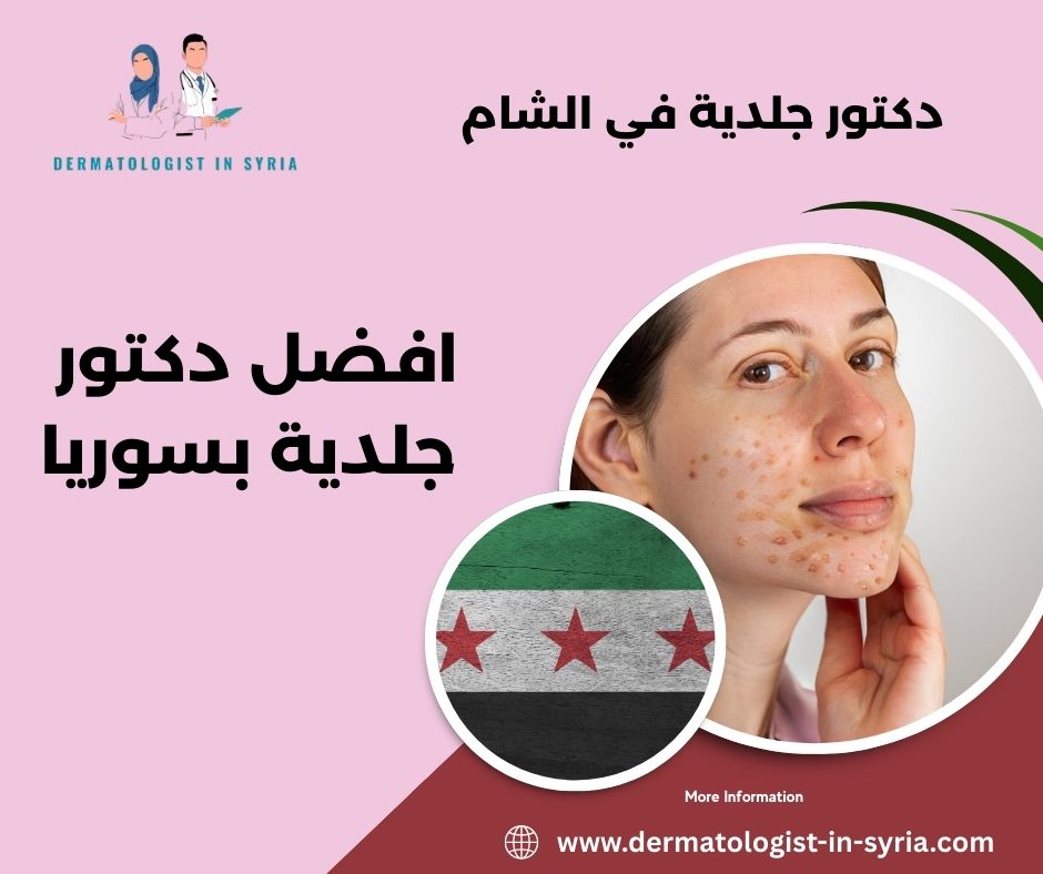 افضل دكتور جلدية بسوريا افضل دكتور جلدية بسوريا