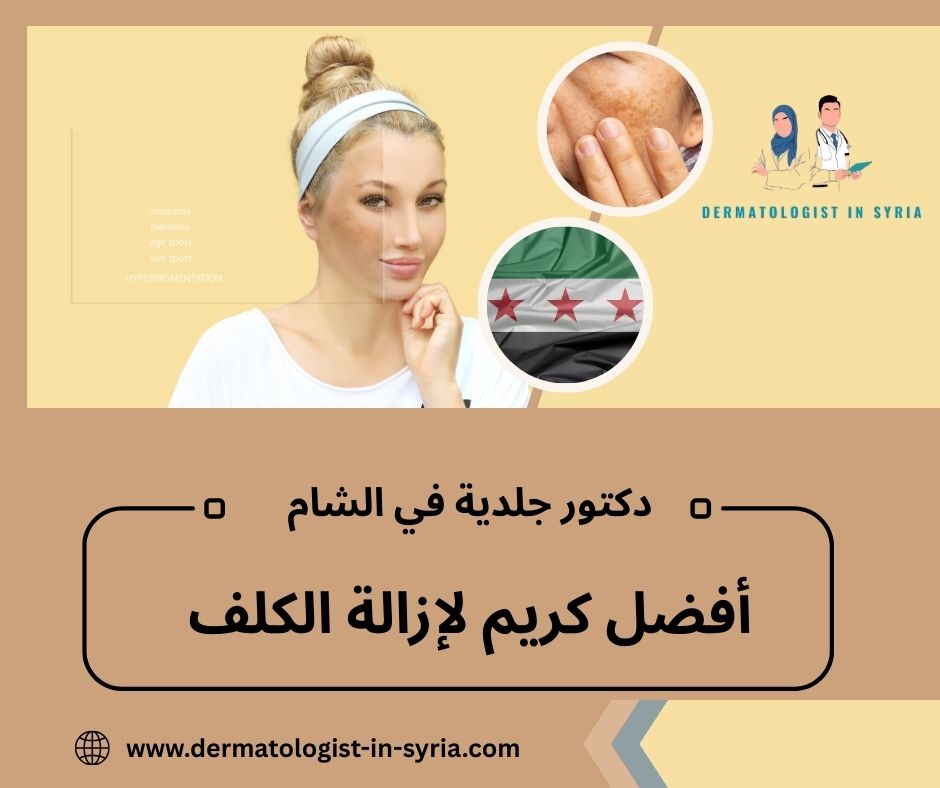 أفضل كريم لإزالة الكلف أفضل كريم لإزالة الكلف