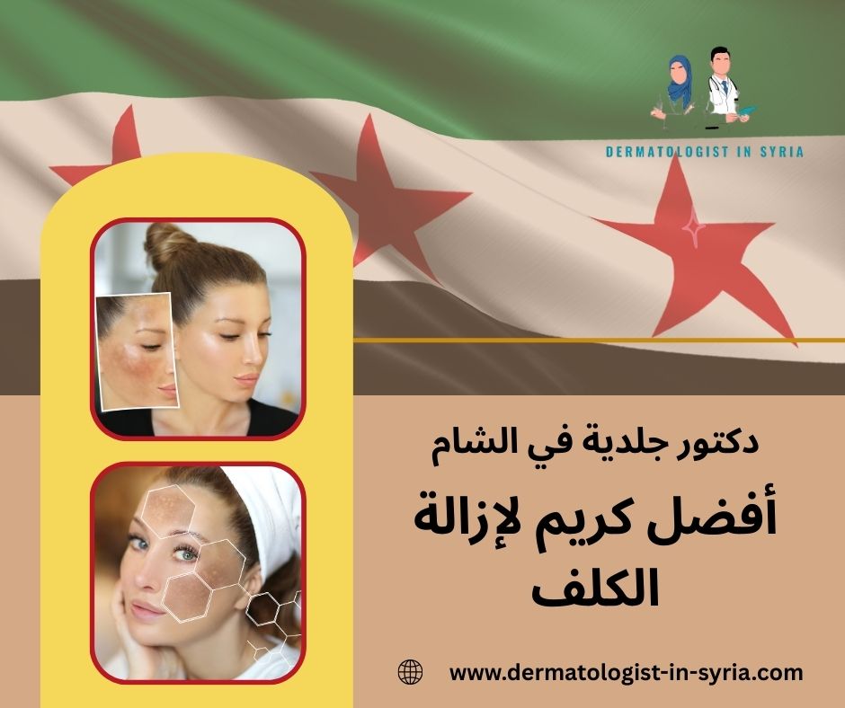 أفضل كريم لإزالة الكلف والتصبغات الجلدية أفضل كريم لإزالة الكلف والتصبغات الجلدية