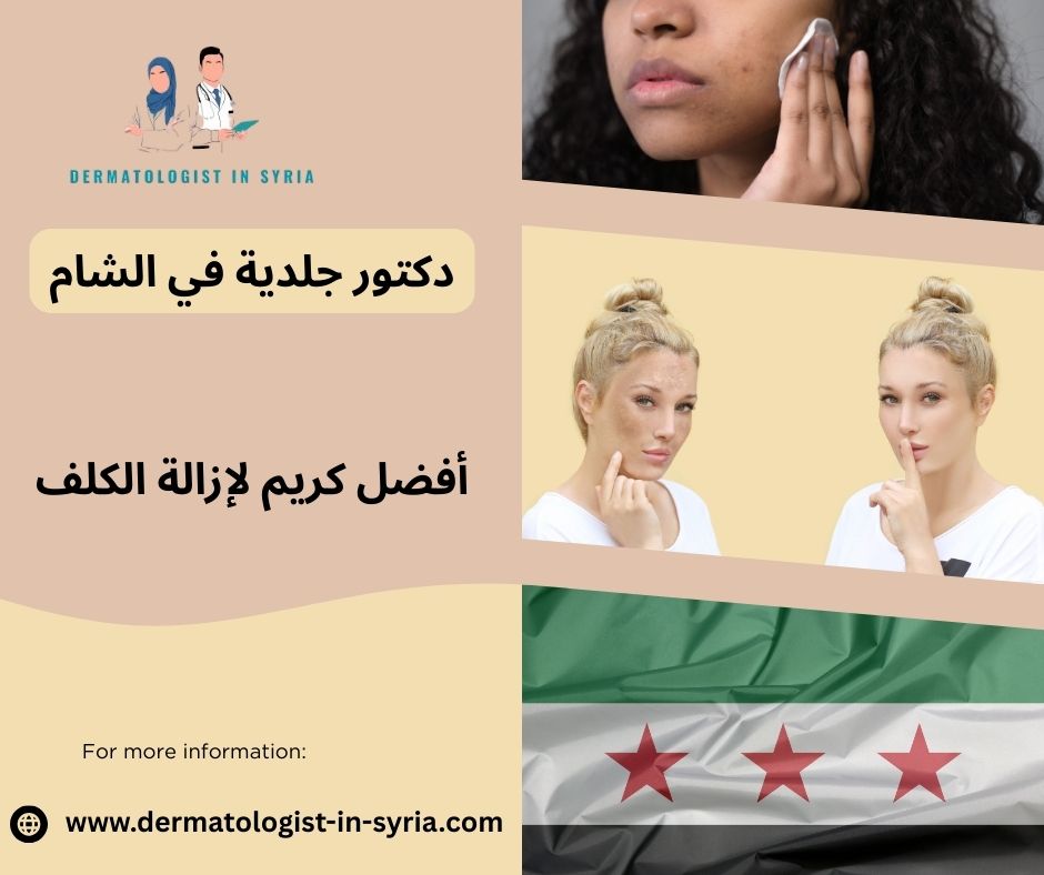 ما هو أفضل كريم لإزالة الكلف ما هو أفضل كريم لإزالة الكلف