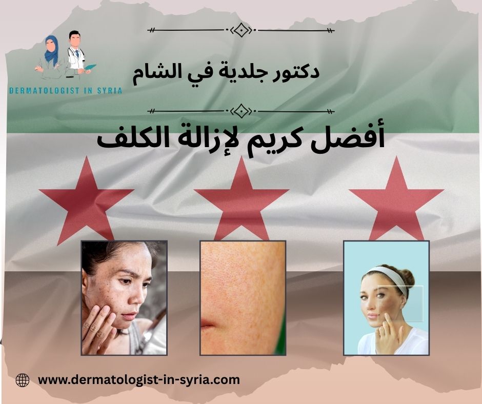 هل يمكن استخدام أفضل كريم لإزالة الكلف بدون وصفة طبية؟ هل يمكن استخدام أفضل كريم لإزالة الكلف بدون وصفة طبية؟