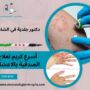 أسرع كريم لعلاج الصدفية بالاعشاب