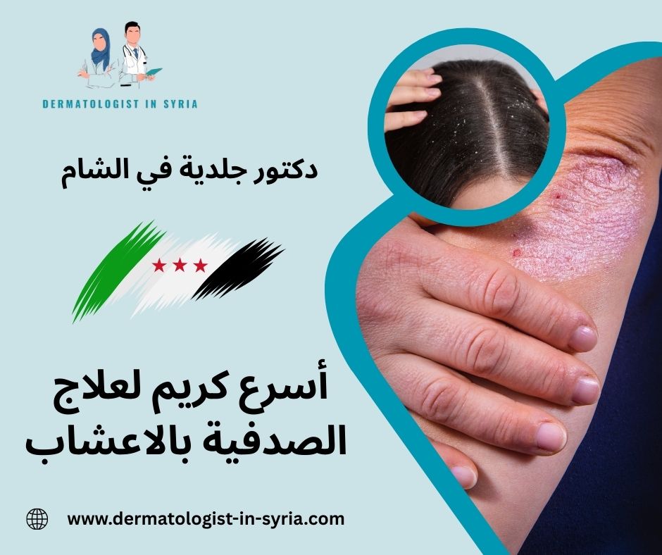 أسرع كريم لعلاج الصدفية أسرع كريم لعلاج الصدفية
