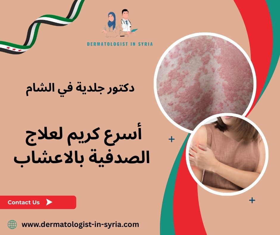 ما أسباب ظهور الصدفية؟ ما أسباب ظهور الصدفية؟