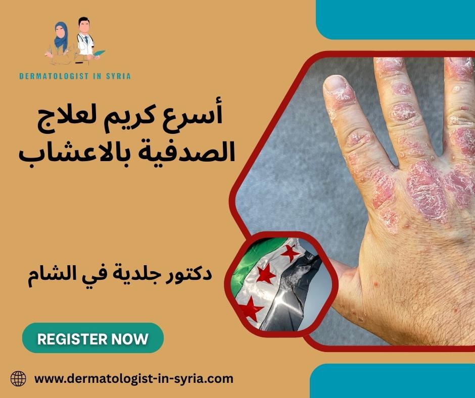 أسرع كريم لعلاج الصدفية بالاعشاب أسرع كريم لعلاج الصدفية بالاعشاب