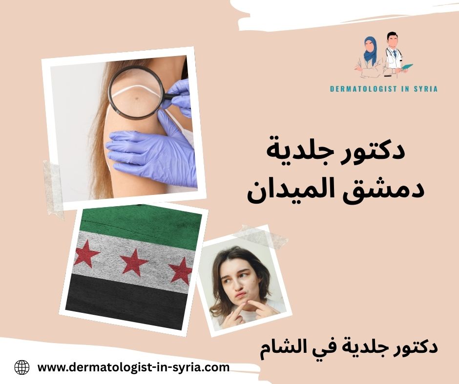 أطباء جلدية في دمشق الجسر الأبيض أطباء جلدية في دمشق الجسر الأبيض