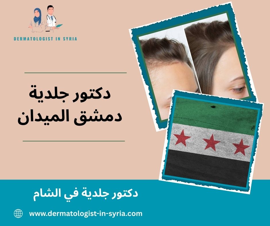 دكتور جلدية دمشق الميدان  دكتور جلدية دمشق الميدان