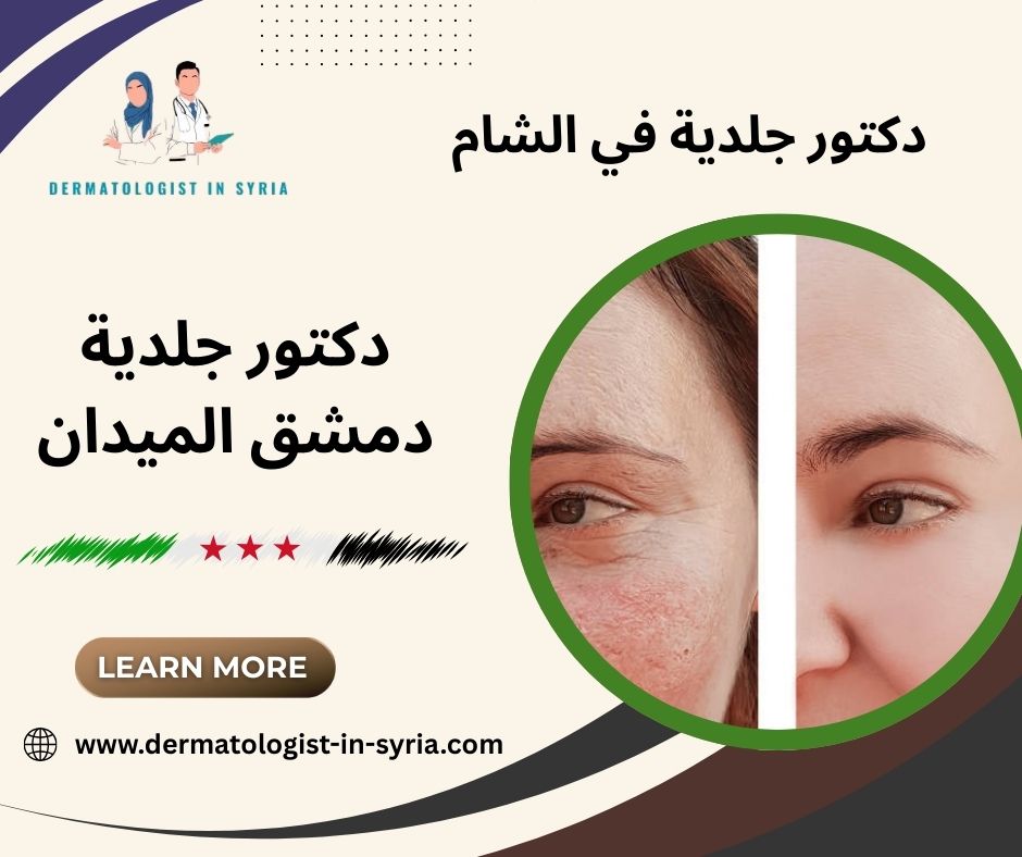 رقم دكتور جلدية ممتاز دمشق رقم دكتور جلدية ممتاز دمشق