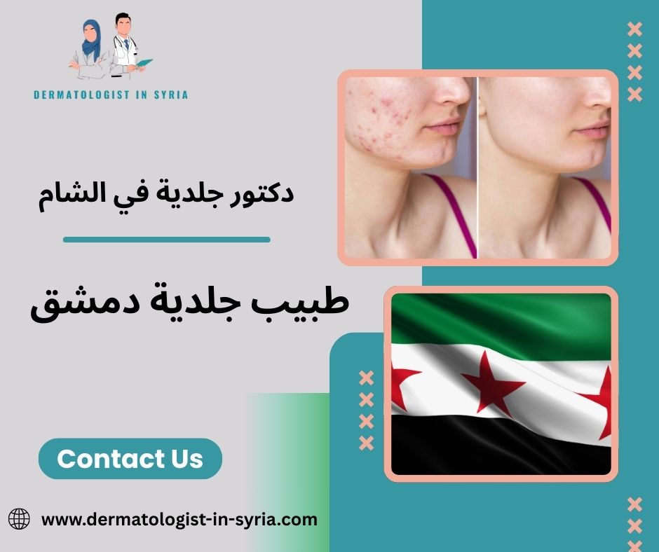 طبيب جلدية دمشق